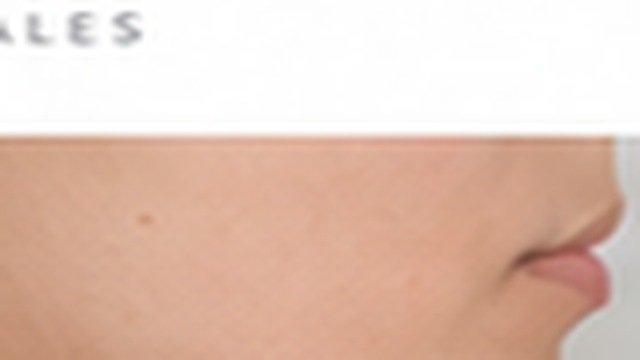 Antes
