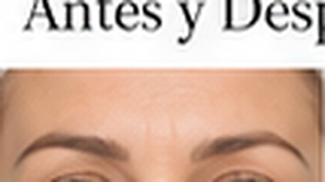 Antes